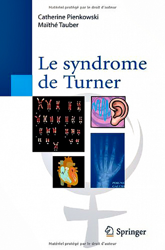 Le syndrome de Turner
