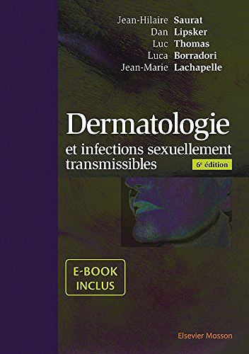 Dermatologie et infections sexuellement transmissibles (6e Edition) - Collectif
