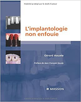 L’implantologie non enfouie - Gérard Aouate