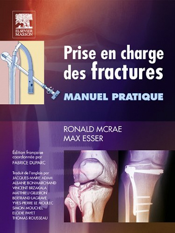 Prise en charge des fractures - Ronald McRae; Max Esser