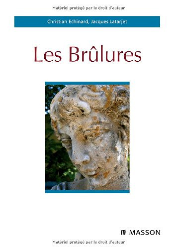 Les brûlures - Christian Echinard