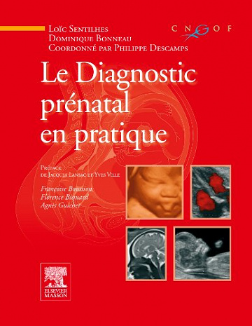 Le diagnostic prénatal en pratique - Philippe Descamps