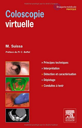 Coloscopie Virtuelle - Mickaël Suissa