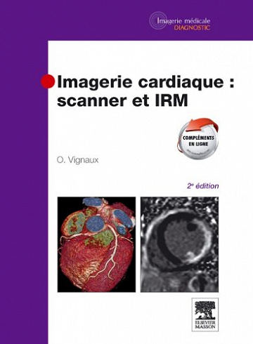 Imagerie Cardiaque : Scanner et IRM - Olivier Vignaux