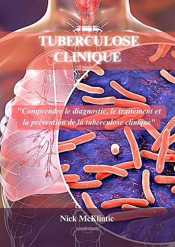 Nick McKlintic - TUBERCULOSE CLINIQUE: " Comprendre le diagnostic, le traitement et la prévention de la tuberculose clinique " (2024)