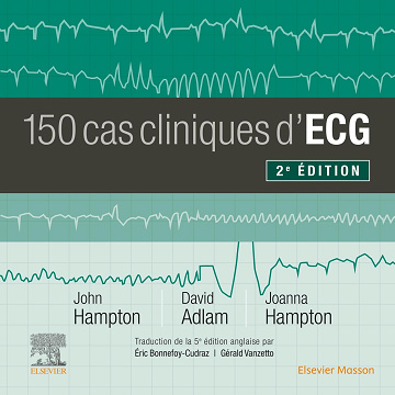 150 cas cliniques d'ECG - David Adlam, Joanna Hampton, John R. Hampton (2023)