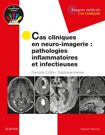 Cas cliniques en neuro-imagerie : pathologies inflammatoires et infectieuses: Path Inflammat Et Infectieuses -  Professeur François Cotton (2018)