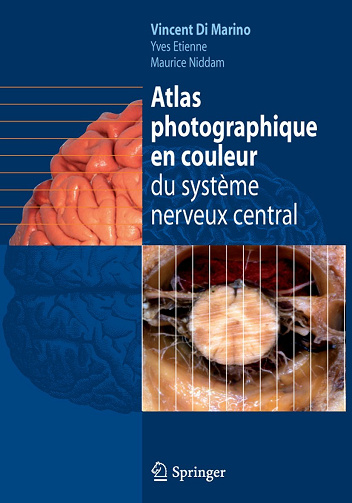 Atlas photographique en couleur du système nerveux central - Vincent Di Marino, Yves Etienne, Maurice Niddam (2010)